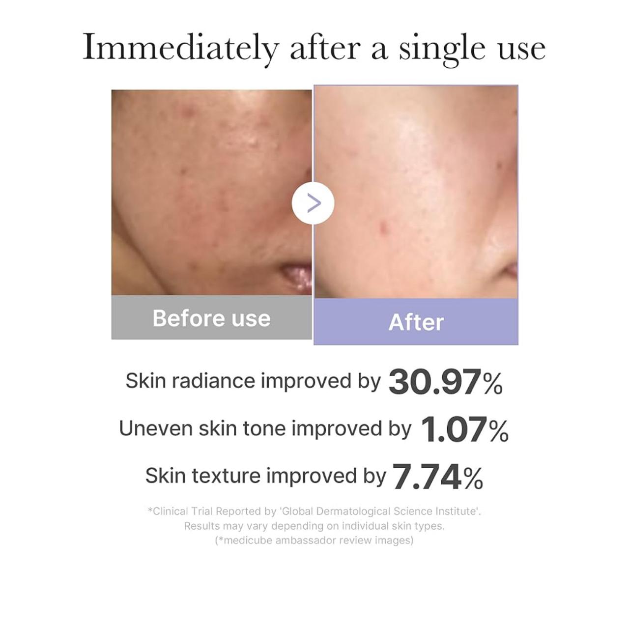 MEDICUBE - AGE-R Booster Pro MINI - Imagem 3